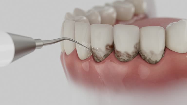 Reliable Dental Implants contractor in Tysons, VA by Smile Center Dentistry